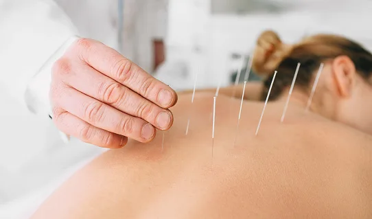 Acupuncture for Pain in Morristown